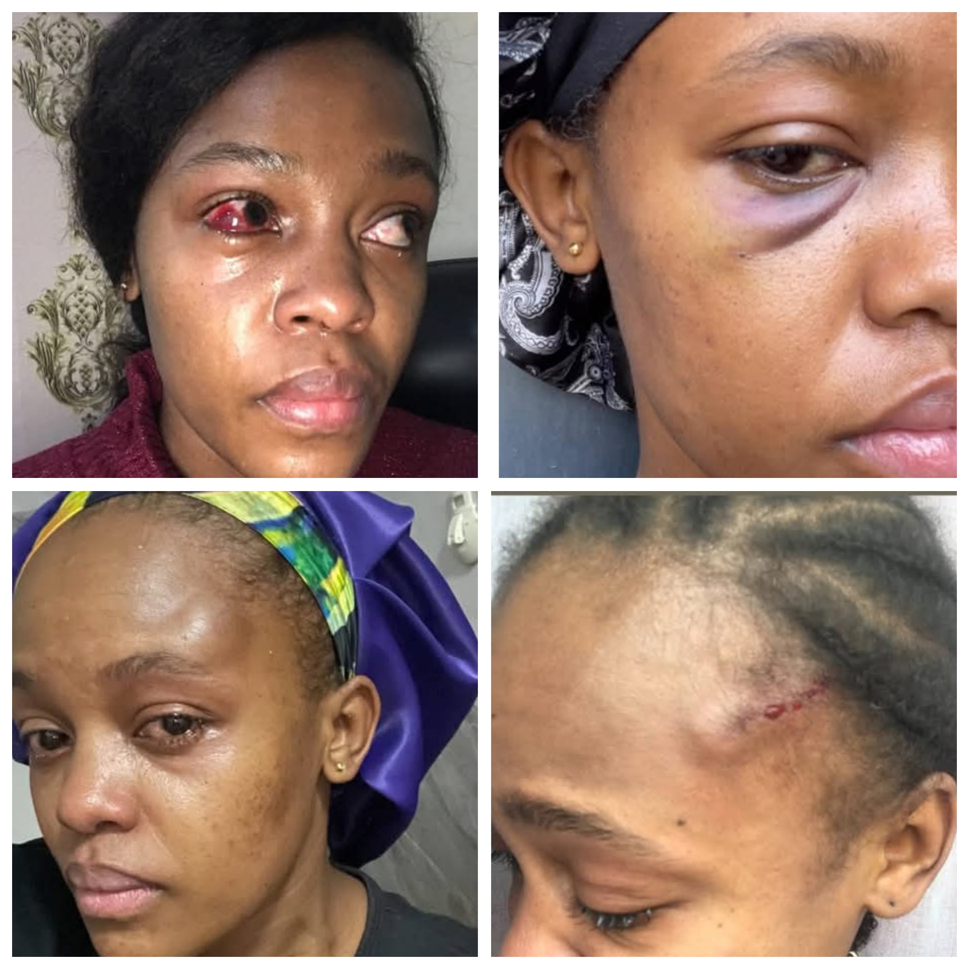 I walked down the aisle on my wedding day with masked bruises – Woman accuses her husband of domestic violence